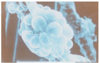 Foto al microscopio di cellule umane fibroplasti ricoperte di silice con il Metodo Biosil